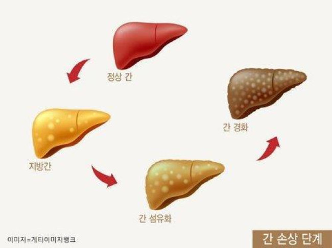 간 손상 단계 